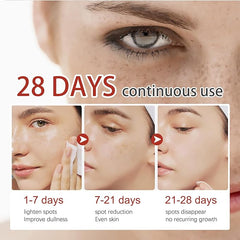 Eelhoe Pigment Correcting Cream (Original) – Fade Dark Spots & Uneven Skin