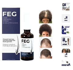 Hair Growth Spray – Fast Hair Regrowth & Strengthening Formula
