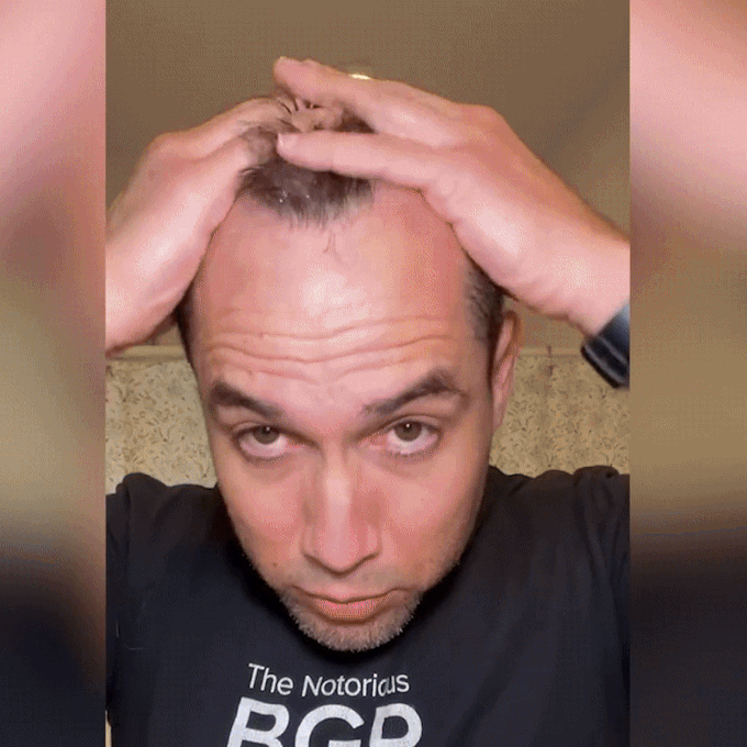 Hair Growth Spray – Fast Hair Regrowth & Strengthening Formula