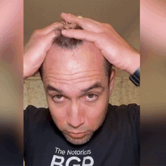 Hair Growth Spray – Fast Hair Regrowth & Strengthening Formula